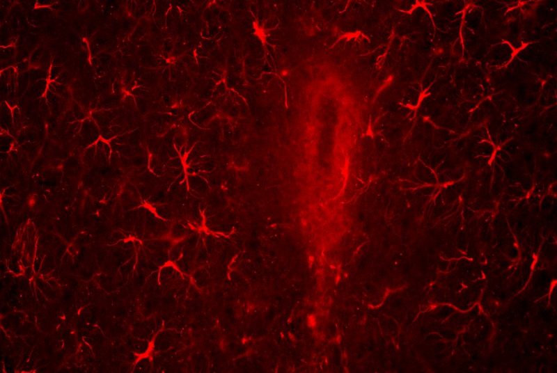 2017 School of Neuroscience Research Fellowship Poster Symposium